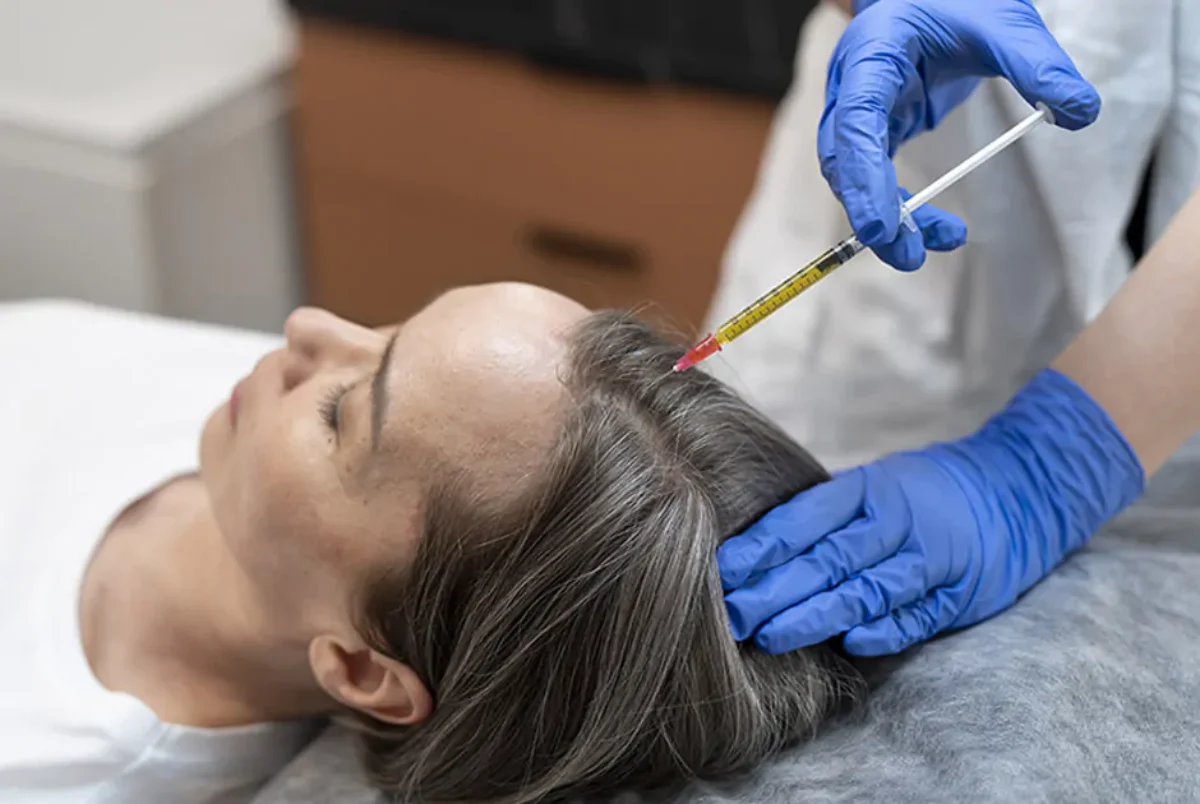 PRP Platelet-Rich Plasma